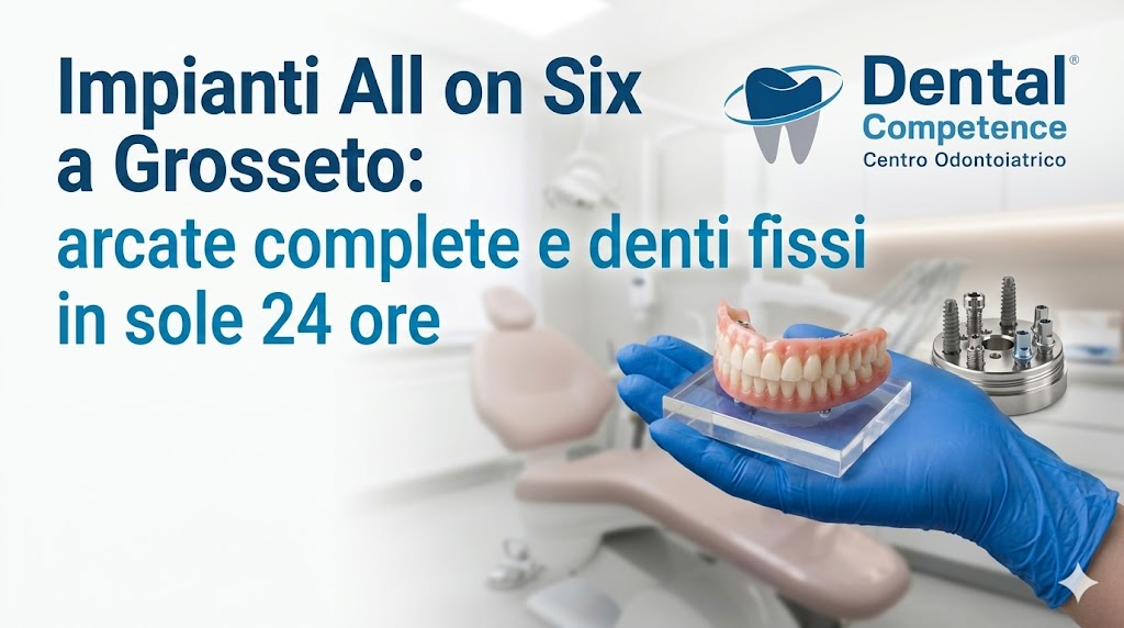 All On Six A Grosseto: Impianti Dentali Completi E Fissi In 24 Ore. Arcata Dentale E Impianti Per Odontoiatria Estetica.