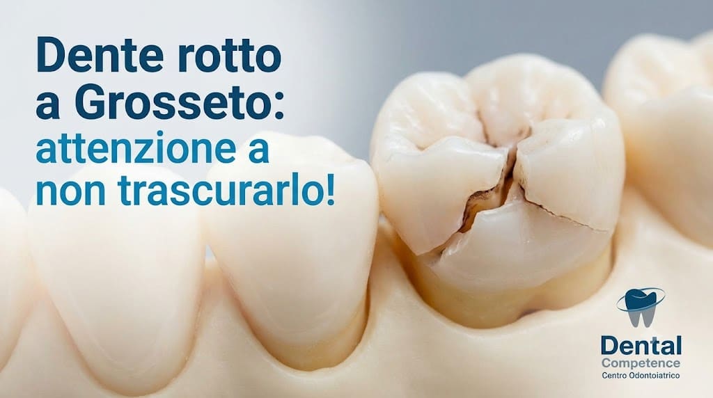 Dente Molare Con Una Crepa Visibile Su Un Modello Dentale Con Il Testo Dente Rotto A Grosseto: Attenzione A Non Trascurarlo