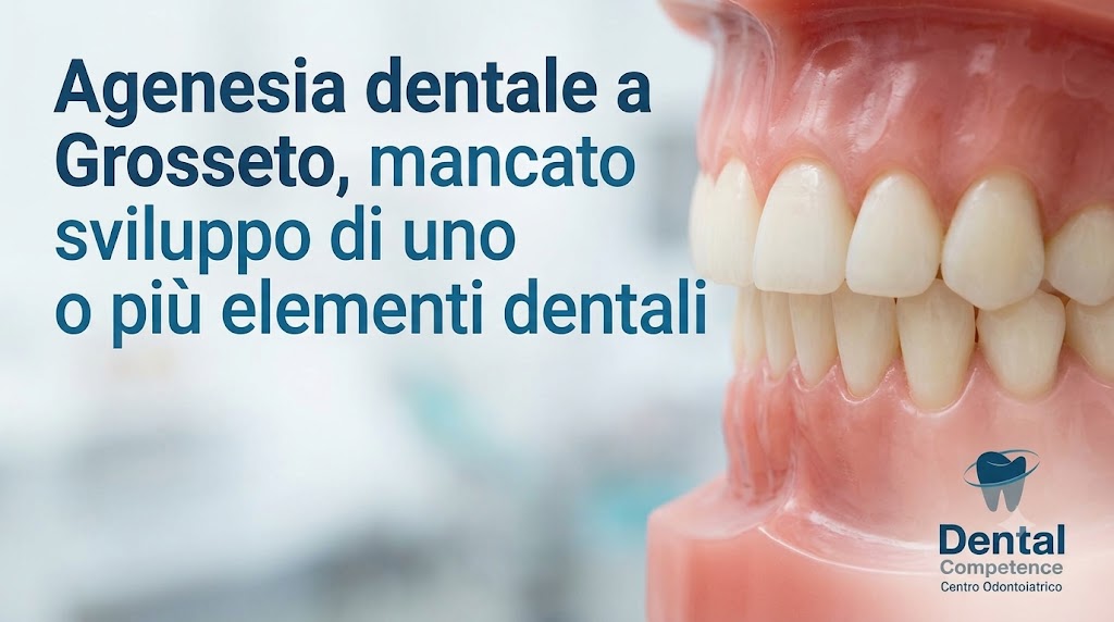 Modello In Resina Di Arcata Dentale Con Testo Agenesia Dentale A Grosseto, Mancato Sviluppo Di Uno O Più Elementi Dentali