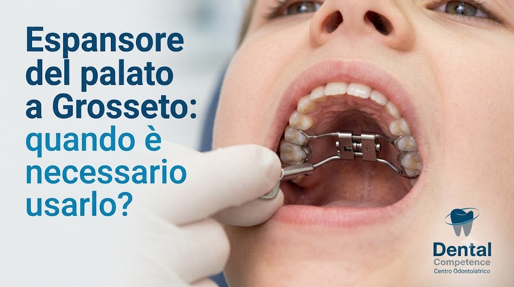 Espansore Del Palato A Grosseto: Quando è Necessario Usarlo?