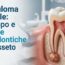 Sezione Di Un Dente Con Granuloma Radicolare E Testo Granuloma Dentale: Sviluppo E Terapie Endodontiche A Grosseto