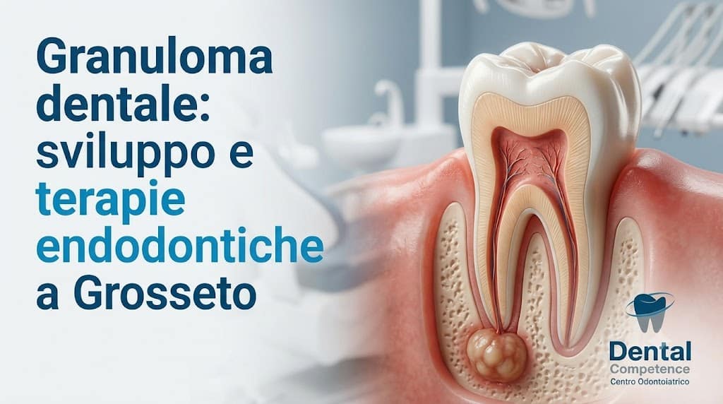 Sezione Di Un Dente Con Granuloma Radicolare E Testo Granuloma Dentale: Sviluppo E Terapie Endodontiche A Grosseto