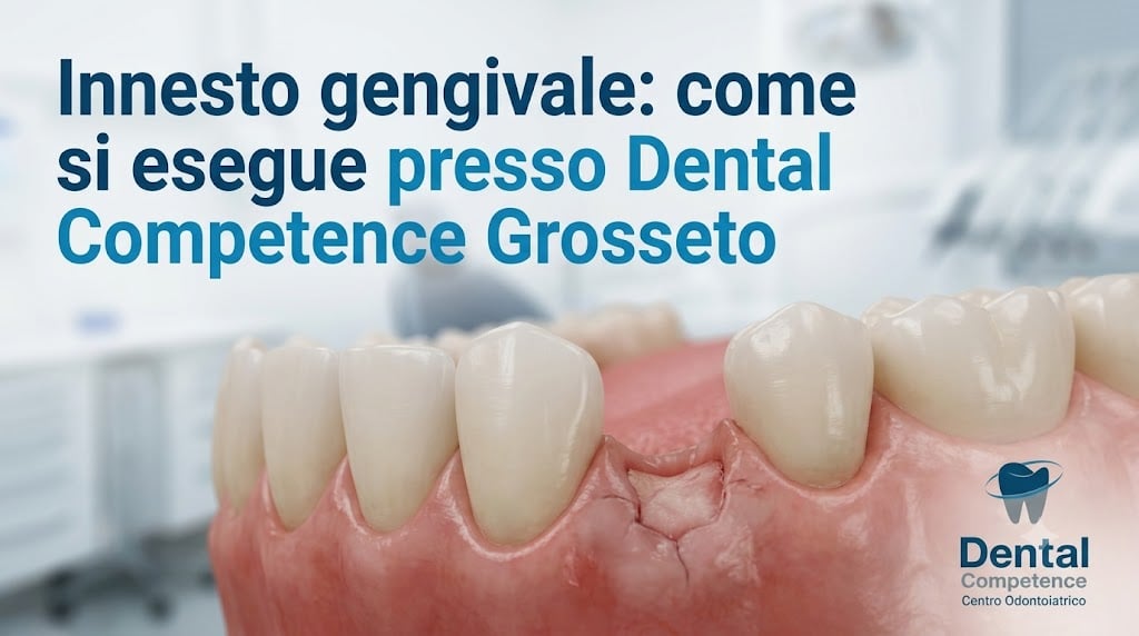 Modello Di Gengiva Con Innesto Tessutale Tra Due Denti E Testo Innesto Gengivale Presso Dental Competence Grosseto.