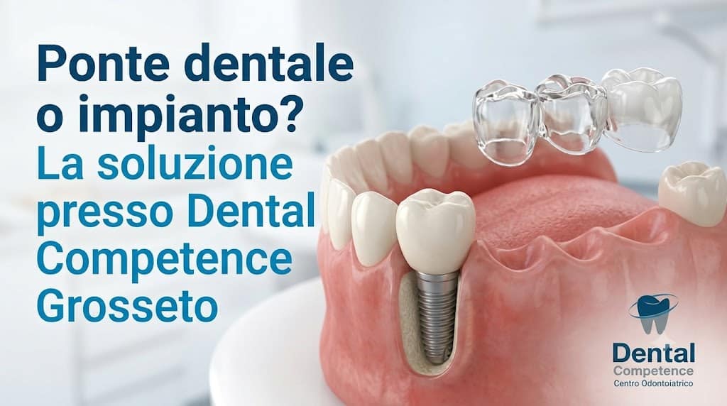 Modello Di Mascella Con Impianto Metallico E Ponte Dentale In Resina, Testo Ponte Dentale O Impianto? Presso Dental Competence